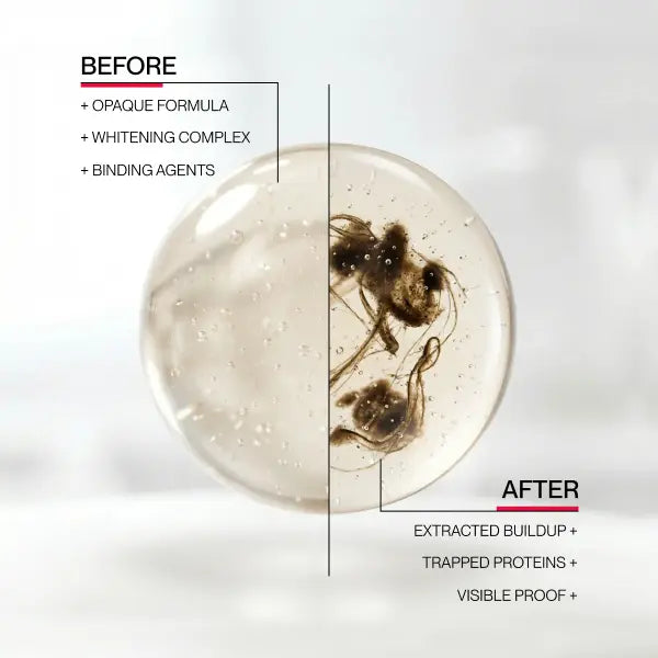 Whitening Mouthwash Lifts Stains & Brightens Your Smile