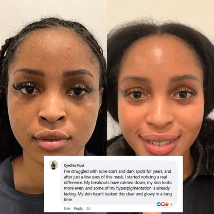 🎁Buy 1 Get 1 FREE🎁 Collagen Night Wrapping Mask – Wake Up to Smoother, Glass-Like Skin